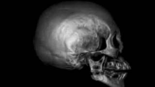 Skull Morph 2