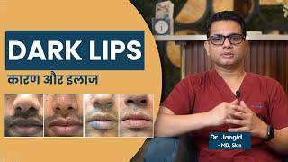 Treatment for Lip Pigmentation | How to lighten dark lips | Dark lips treatment in Delhi | @SkinQure