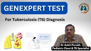 GeneXpert  or CB NAAT test for Diagnosis of Tuberculosis I Dr Ankit Parakh, Child TB Specialist