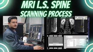 MRI L.S. Spine scanning process | mri lumbosacral spine scan on Siemens symphony 1.5 Tesla machine.