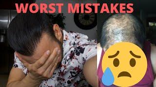 Two Biggest Hair Loss Mistakes