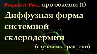 Системная склеродермия (ССД). Диффузная форма. Случай из врачебной практики.