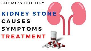 Kidney stones causes, symptoms and treatment