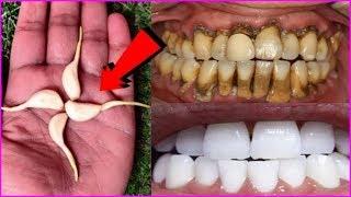 In just 2 minutes this recipe will brighten yellow dirty teeth like pearls. How to Whiten Teeth