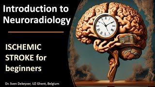 Imaging of Acute Ischemic Stroke: the basics!