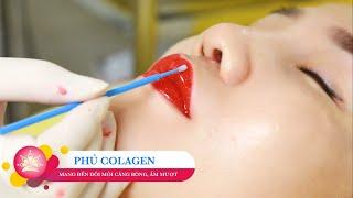 CÁC BƯỚC TRONG QUY TRÌNH PHUN MÔI COLLAGEN