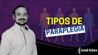 Tipos de PARAPLEGIA | José Góes