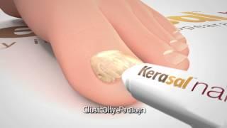 Kerasal Nail: Restore Healthy Nail Appearance (30 Sec)