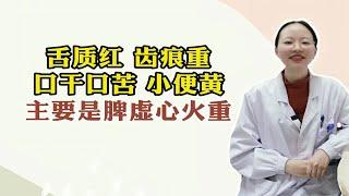 舌质红 齿痕重口干口苦 小便黄主要是脾虚心火重