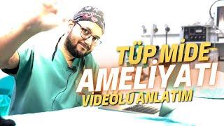 TÜP MİDE AMELİYATI NASIL YAPILIR? VİDEOLU ANLATIM