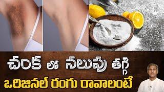 How to Get Rid of Dark Underarms | Remedy to Lighten your Armpits | Dr. Manthena's Beauty Tips