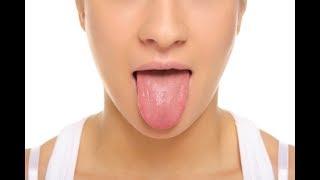 What a Healthy Tongue Should Look Like