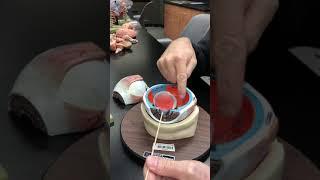 Quick Review of the Eye with Dr. Masi