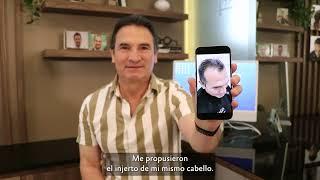 TESTIMONIO INJERTO CAPILAR/ZONA FRONTAL (ENTRADAS)
