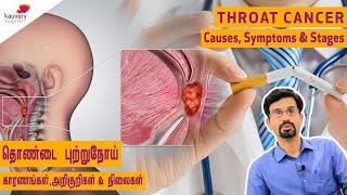 Throat Cancer, Causes, Symptoms, Stages ( Tamil )