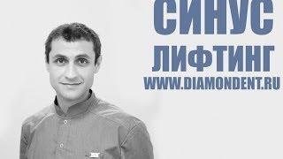 Операция синус лифтинг