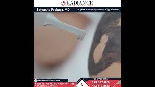 Carbon Laser Peel #radianceclinic  #skincare #skinwhitening #skincaretips #skinrejuvenation