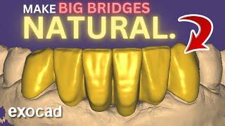 ANTERIOR Bridge EXOCAD. 2024 Tutorial