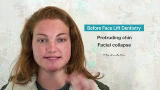 How To Fix a Protruding Chin Without Surgery