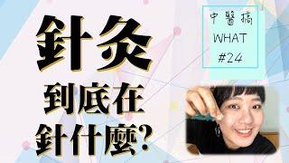 (已抽出！) 頭痛醫腳，腳痛醫頭? 針灸到底在針什麼? /// 中醫搞WHAT #24