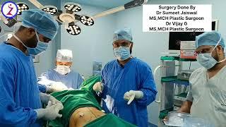 Male To Female Gender Change Surgery In India Delhi Mumbai Kolkata Hyderabad Bangalore Chandigarh