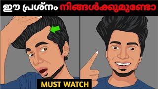 16-29 പ്രായക്കാരുടെ ഏറ്റവും വലിയ പ്രശ്നം7 WAYS TO STOP HAIR FALL *NATURALLY* REGROWHAIR ||HAIR FALL