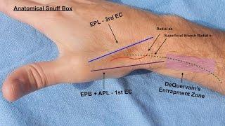 Live Surgery: De Quervain's Tenosynovitis: 1st Extensor Compartment Release