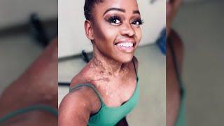 Boundary-shattering ballerina Michaela DePrince dies at 29 | REUTERS