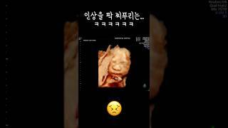 드디어 입체초음파!흔드니까 인상 팍 쓰는 아가(벌써부터 승질머리 보이는 건가..)신기하고 귀엽고 빨리 보고싶다 찰떡이#입체초음파 #베이비페이스 #임신27주 #임산부브이로그