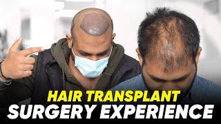 Hair Transplant in Udupi | Best Results & Cost of Hair Transplant in Udupi