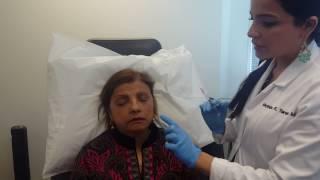 Liquid Facelift | Tareen Dermatology