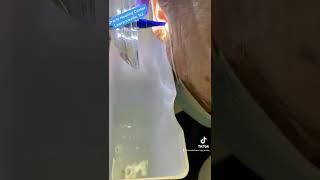 Earwax removal with the Earigator really works!