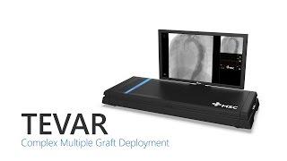 Thoracic Endovascular Aortic Repair (TEVAR)