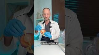 Альтернатива обычному катетеру | катетер для мочевого пузыря #катетер #медицина #уролог #доктор #топ