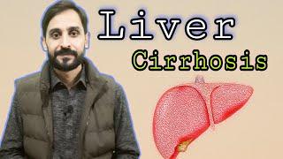 Liver Cirrhosis