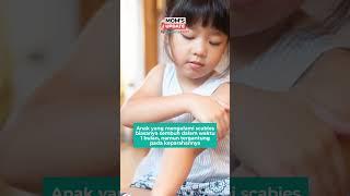 Waspada Scabies pada Anak, Kenali Penyebabnya