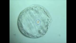 Assisted Hatching - Embryo Collapse