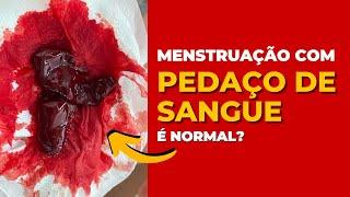 Menstruação com pedaços de sangue é normal?