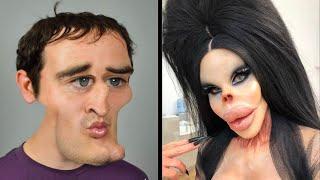 Before and After Plastic Surgery - Supermodel Pixee Fox's Aesthetic Disaster