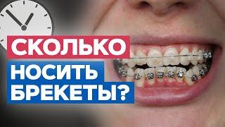 Сколько нужно носить брекеты? ⎸ ТОП-5 факторов, влияющих на срок ортодонтического лечения