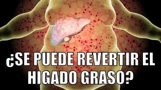 Todo sobre el hígado graso: ¿se puede revertir? - Doctor Bayter