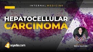 Hepatocellular Carcinoma | Medicine Student | Medical Lecture | V-Learning™ | TRAILER