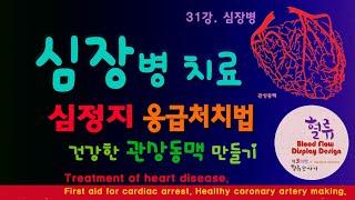 심장병 31강. 심장 질환치료 심정지 응급처치 방법 건강한 관상동맥 만들기. Treatment of heart disease. First aid for cardiac arrest.