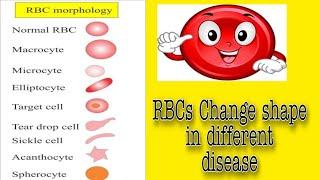 RBC Morphology (Lecture No 2)