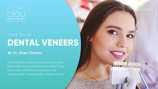 [Bleu Dentistry] Case Study: Dental Veneers