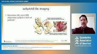 SAA 6th Annual Global Spondyloarthritis Summit: Dr. Liron Caplan