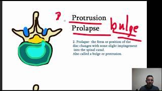 Intervertebral Disk Herniation (prolapse) - Four Stages of Herniation.  Made simple