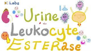 Urine Leukocyte Esterase (Urinalysis) - Urinary Tract Infections (UTI) - Labs Playlist