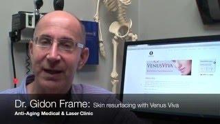 Dr. Gidon Frame talks about Venus Viva for skin resurfacing