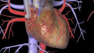 Heart Bypass Surgery (CABG)